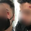 Casal gay que denunciou agressões em bar relata ameaças de seguranças