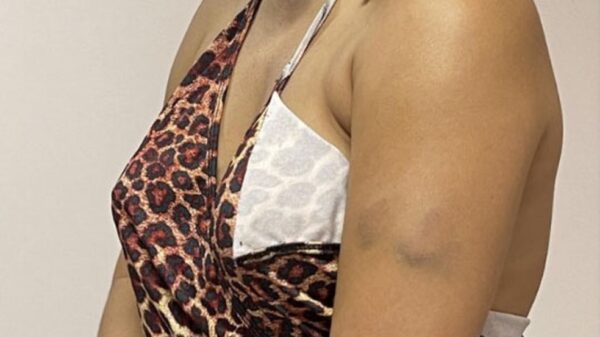 Mulher agredida por médico em bairro nobre de Salvador